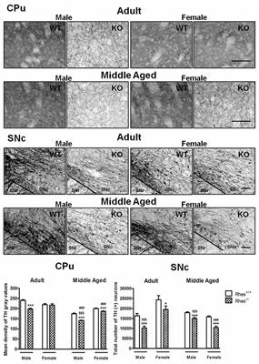 Rhes Counteracts Dopamine Neuron Degeneration and Neuroinflammation Depending on Gender and Age